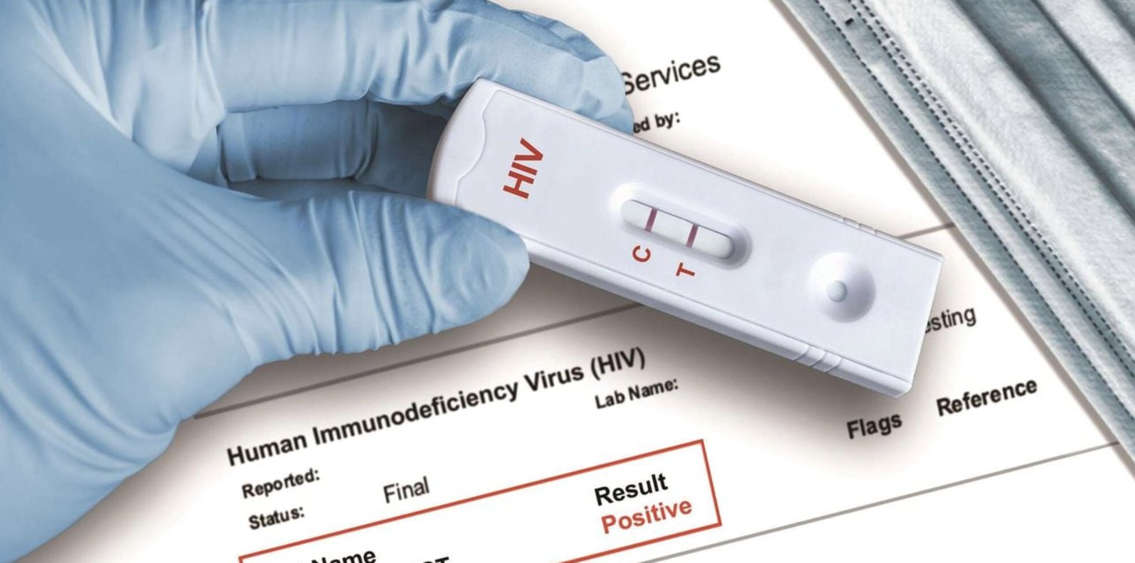 norwegian-man-cured-of-hiv-after-stem-cell-transplant-doctors-announce Image