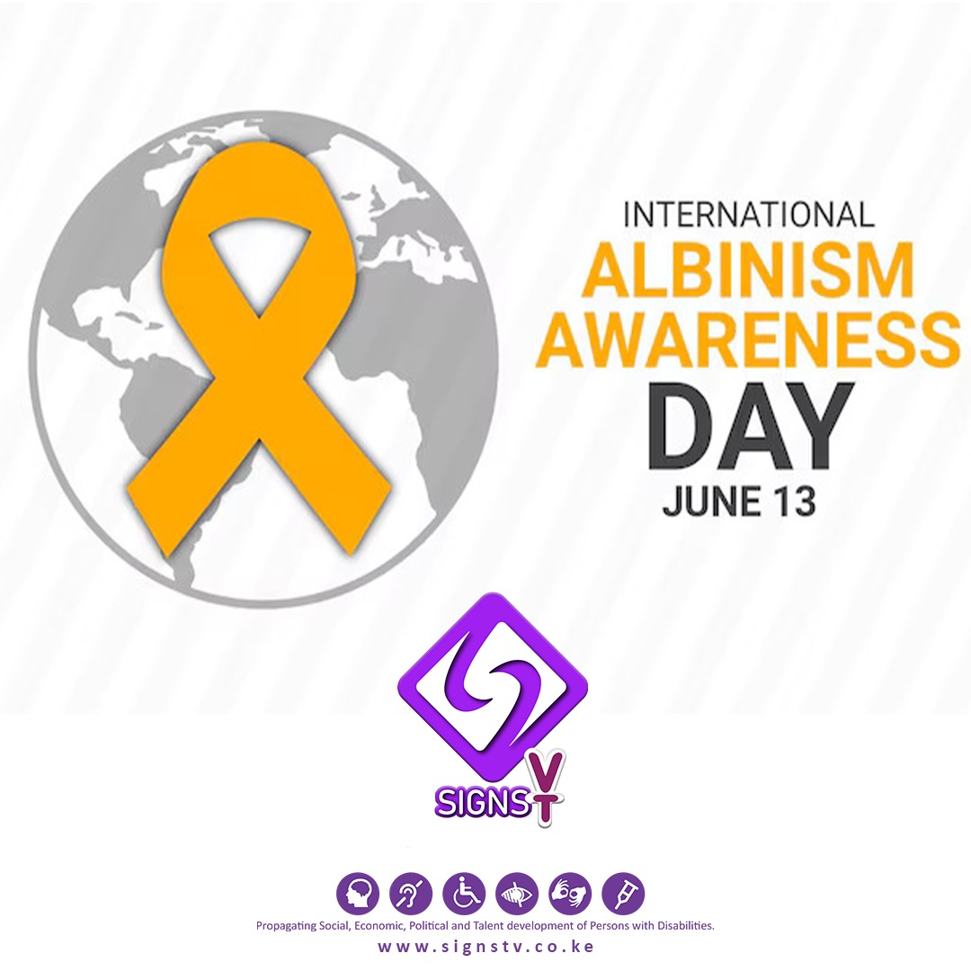 world-marks-international-albinism-awareness-day-with-renewed-push-for-inclusion-and-rights Image