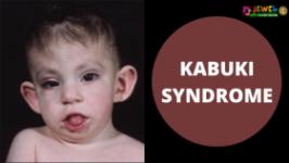 kabuki-syndrome Image