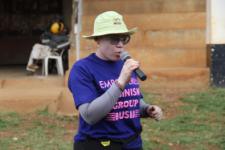 locals-urged-to-stop-discriminating-persons-with-albinism Image