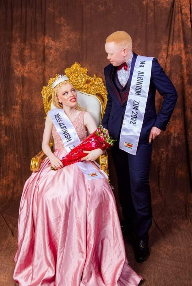Southern Africa Mr. And Miss Albinism 2022