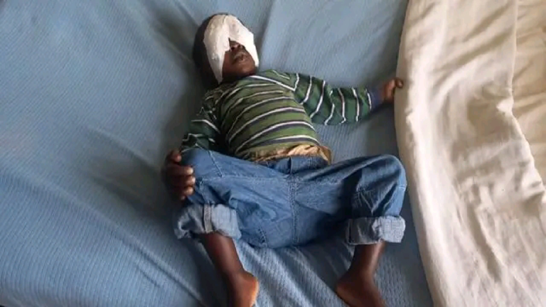 Kisii Suspect Of A Minor Eyes Gouged Arraigned In Court