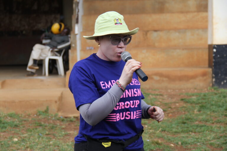 Locals Urged To Stop Discriminating Persons With Albinism